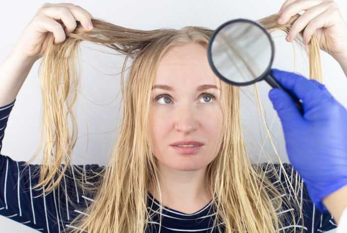 Λιπαρά μαλλιά: Χρειάζεστε μια λύση για να απαλλαγείτε από τα λιπαρά μαλλιά χωρίς να τα λούσετε