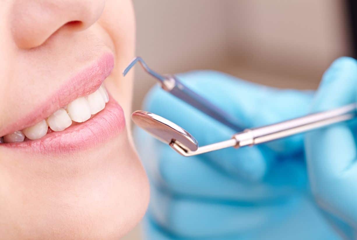 Πώς βοηθάει το σφράγισμα στην πρόληψη της τερηδόνας;