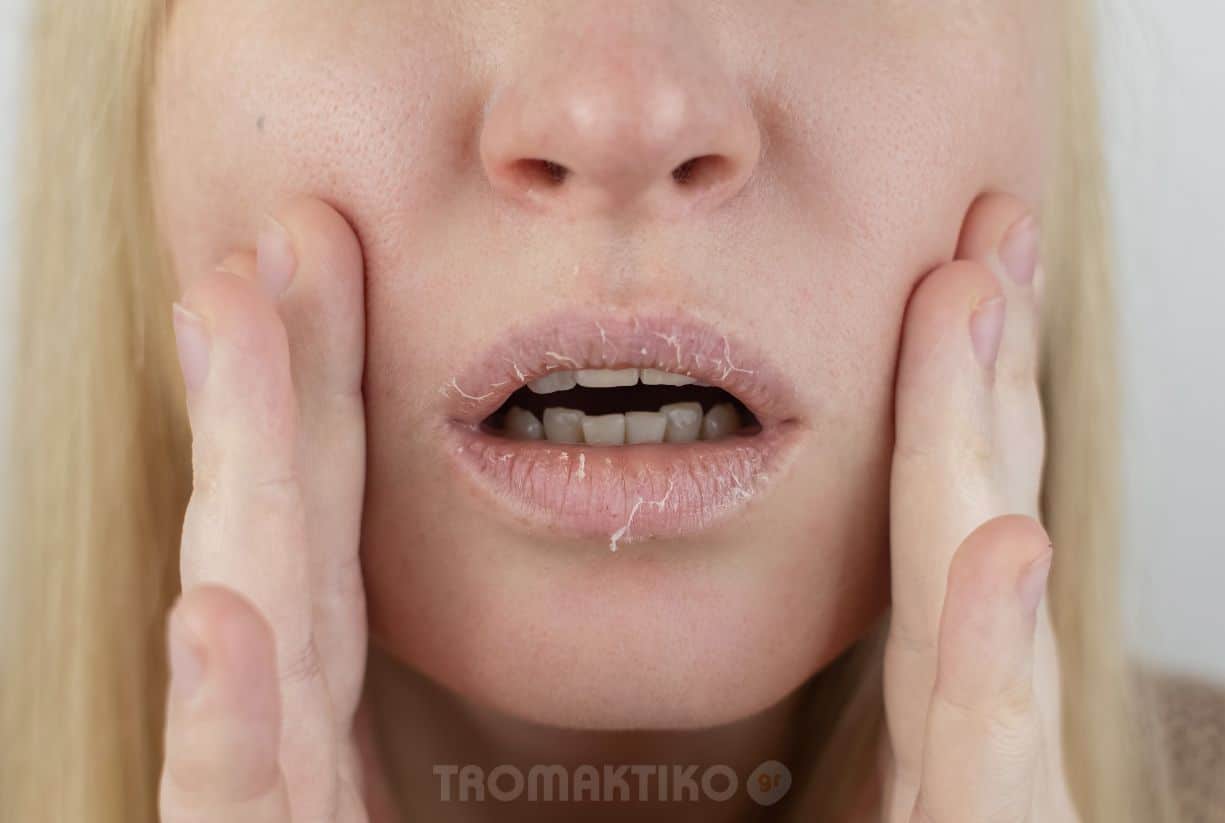 Αντιμετώπισε την ξηροδερμία με αυτούς τους εύκολους τρόπους