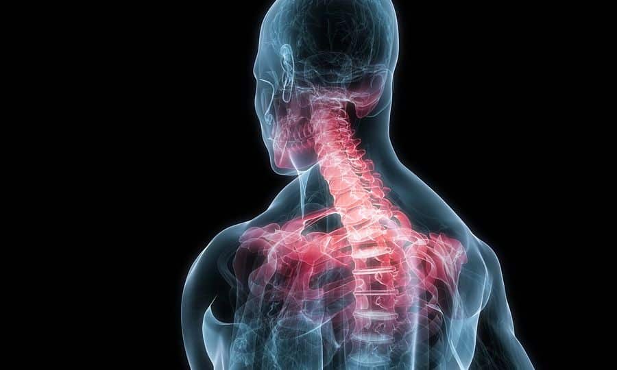 Αυχενικό σύνδρομο: Πάσχουν 1.000.000 Έλληνες