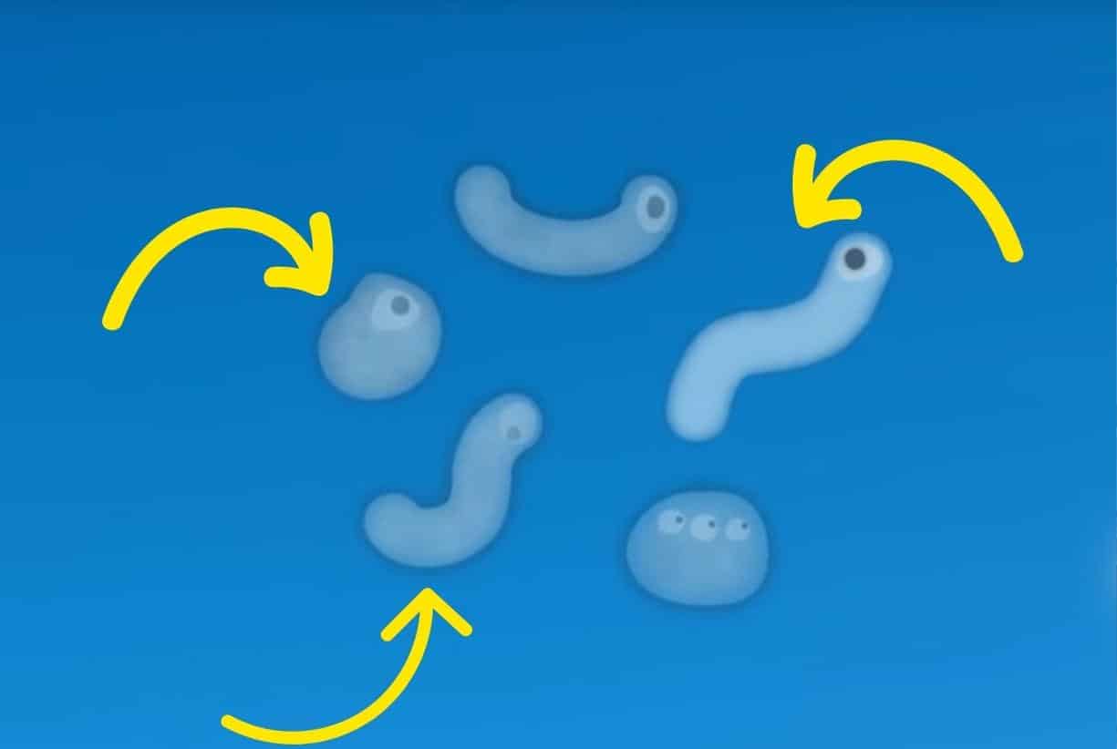 Τι είναι αυτά τα σημάδια που αιωρούνται μπροστά στα μάτια μου;