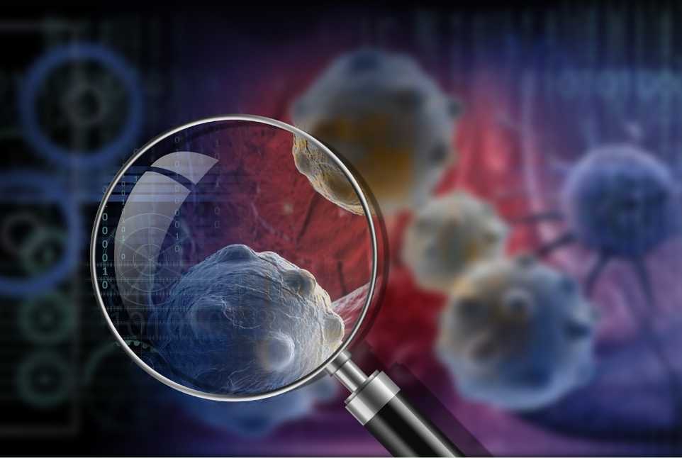 Γιατί θερίζει ο καρκίνος στην Ελλάδα;