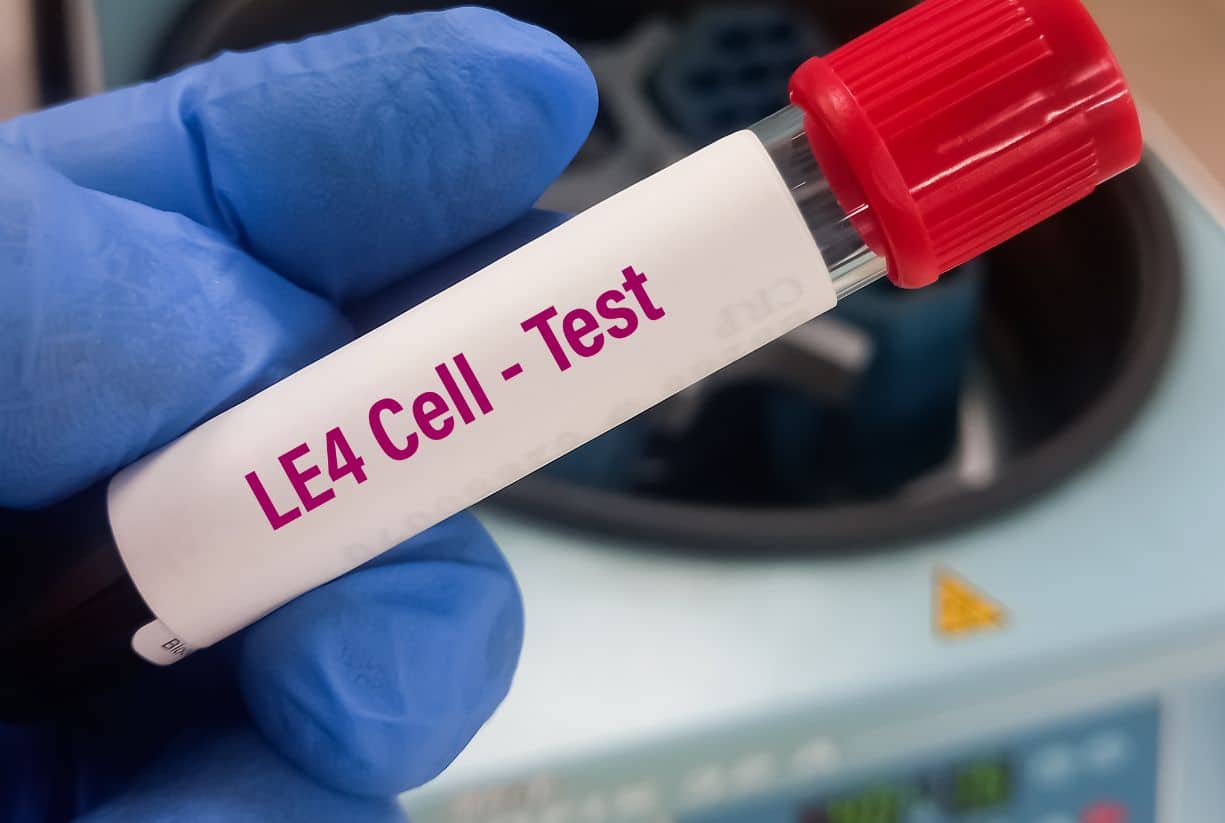 Αυτοάνοσα νοσήματα: Ποια συμπληρώματα διατροφής τα προλαμβάνουν